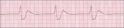 Identify the following rhythm