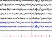 Quiz SMA Sleep Quiz (EEG+Arousals)