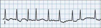 Identify the following rhythm