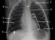 Quiz Location of Thorax Anatomy