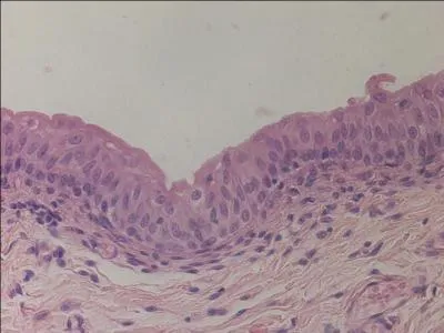 What is the specific tissue type?