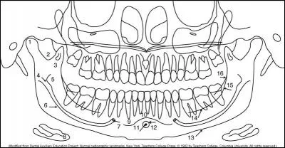 What is the anatomic landmark at #1?